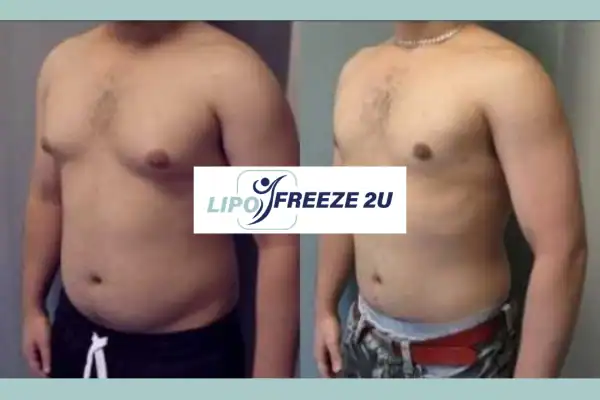 How Long Does It Take to See Results Daventry?