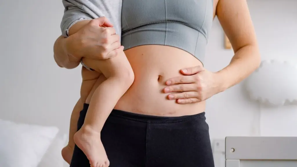 How Long Does It Take for Your Stomach to Go Back to Normal After Pregnancy?