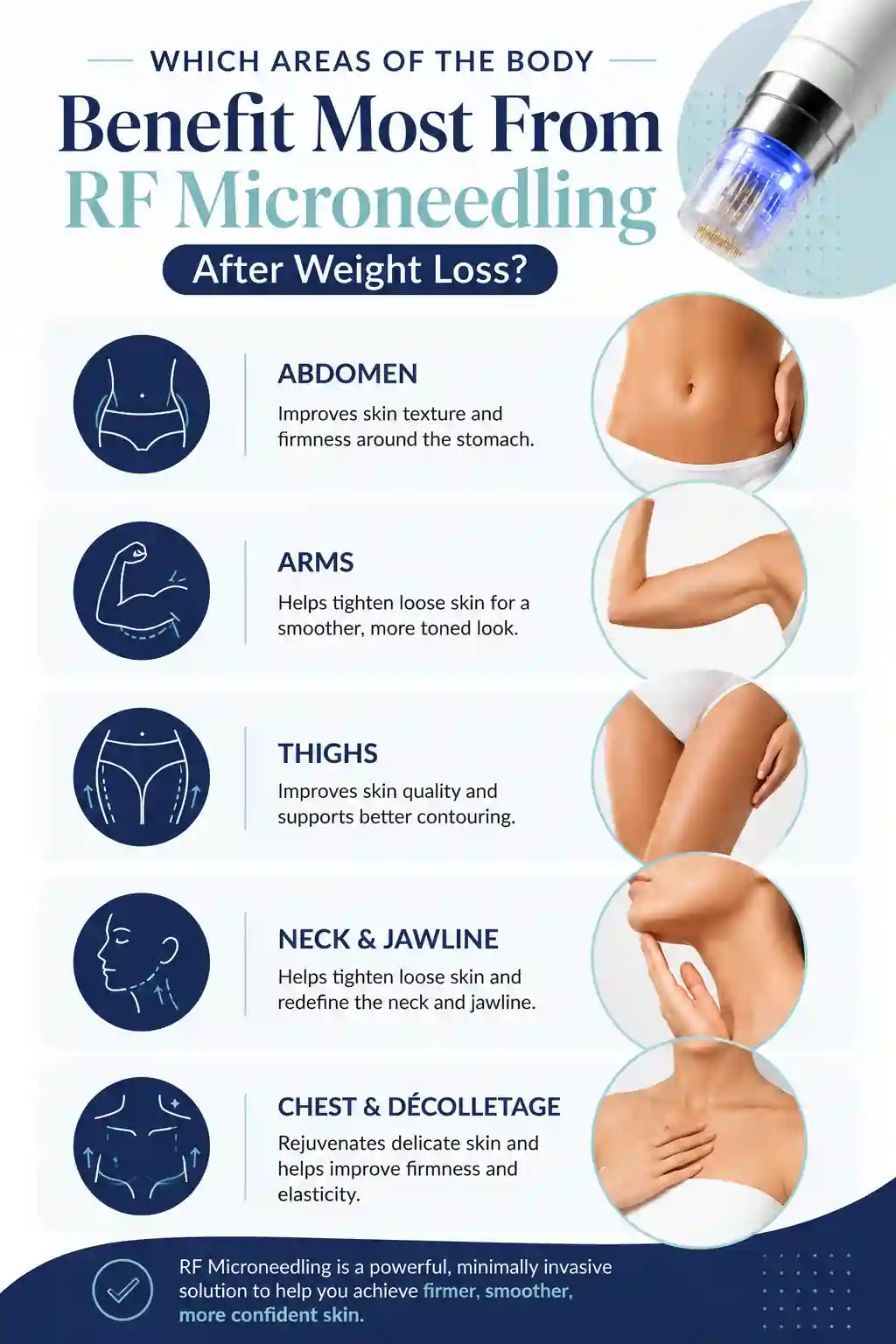 Which Areas of the Body Benefit Most From RF Microneedling After Weight Loss Daventry
